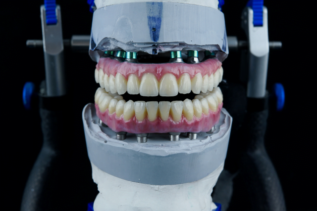 Proteza dentara - SyroDent