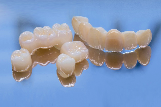 Coroane dentare zirconiu - Clinica SyroDent Bucuresti