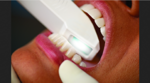 Amprentarea dentara digitala